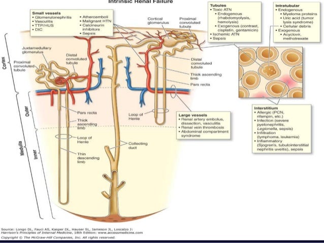 Sinusitis signs Diarrhea