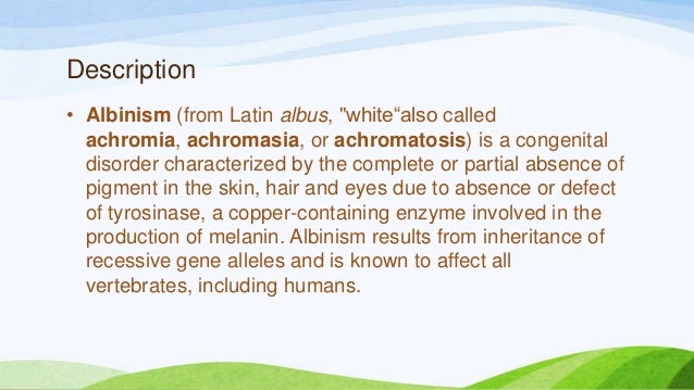 a description of oculocutaneous albinism which involves the absence of melanin In humans, there are two principal types of albinism: oculocutaneous, affecting the eyes, skin and hair, and ocular affecting the eyes only most people with oculocutaneous albinism appear white or very pale, as the melanin pigments responsible for brown, black, and some yellow colorations are not present. a description of oculocutaneous albinism which involves the absence of melanin In humans, there are two principal types of albinism: oculocutaneous, affecting the eyes, skin and hair, and ocular affecting the eyes only most people with oculocutaneous albinism appear white or very pale, as the melanin pigments responsible for brown, black, and some yellow colorations are not present.