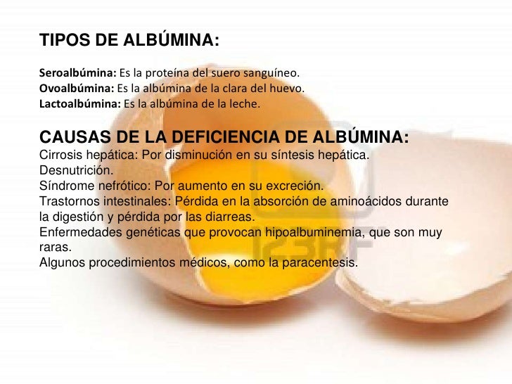 Albumina