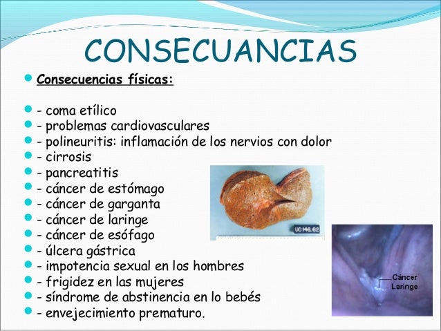 Las medicinas de alcohólico kolme