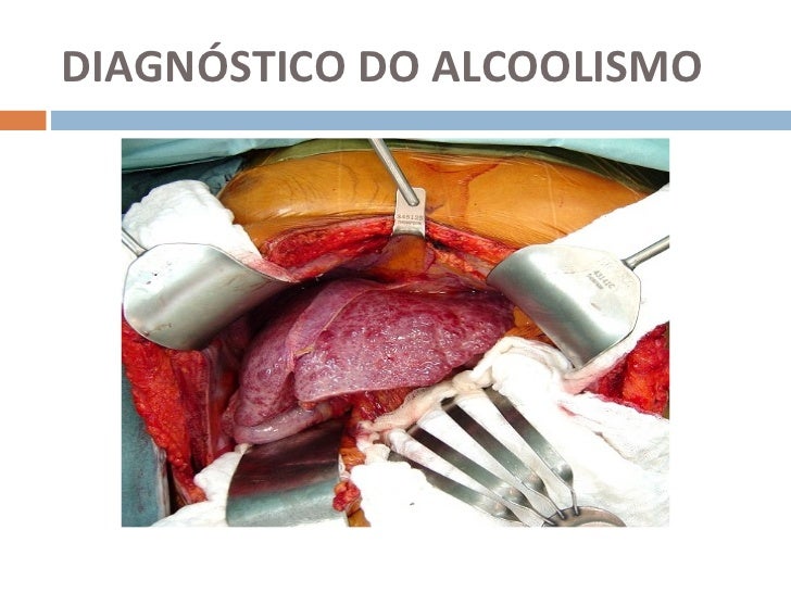 O que o alcoolismo de doenças pode causar