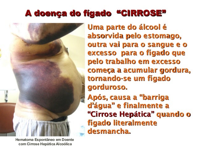 Tratamento de saída de alcoolismo