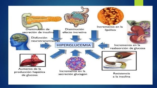 Alejandra diabetes mellitus Alejandra diabetes mellitus
