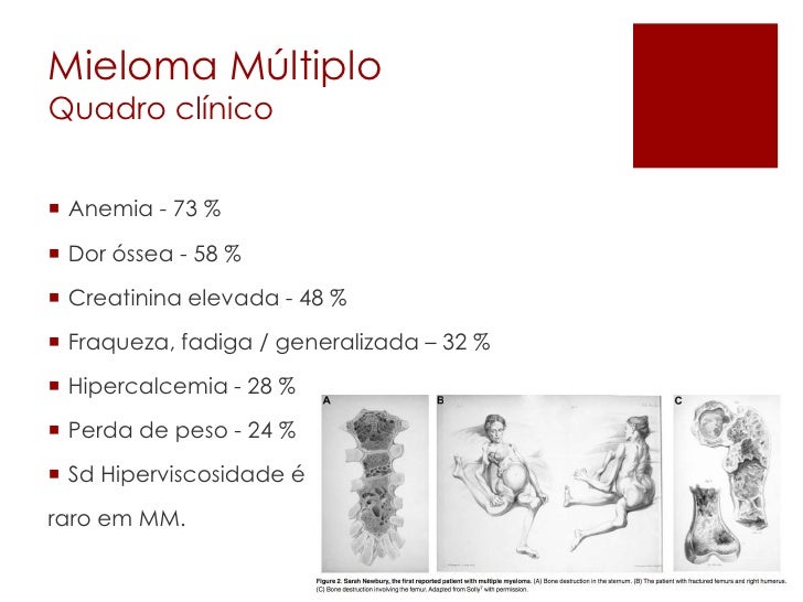 Perda De Peso Rapida Anemia