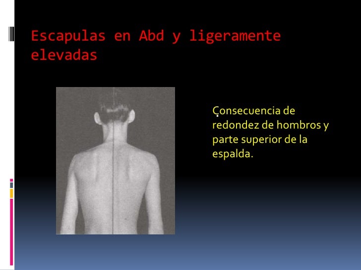Lfk a sheynoy a la hernia de la columna vertebral del vídeo