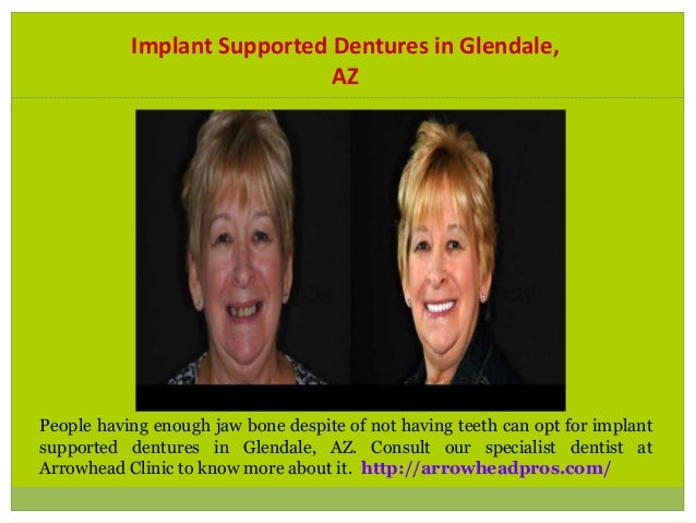 dental-implant-specialist-in-peoria-az-1-638.jpg?cb=1483613055