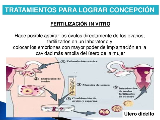 Alteraciones Del Aparato Reproductor Femenino Alteraciones Uterinas