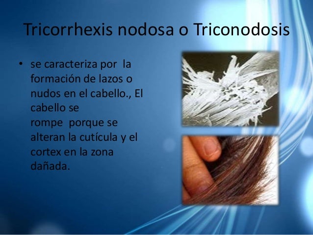 Las recetas para el tratamiento sekuschihsya el cabello