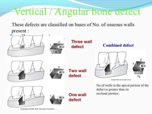 Alveolar bone in health and disease