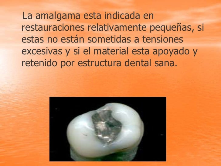 Amalgama.