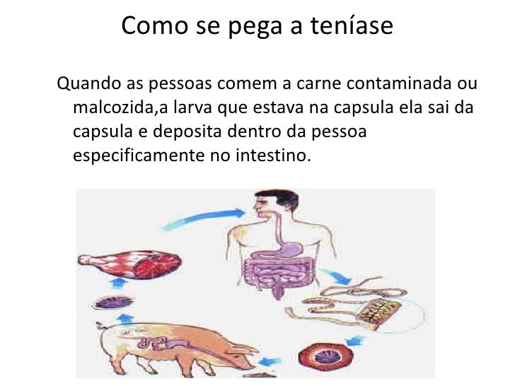 Vermes helminths sinais da sua existência em um organismo
