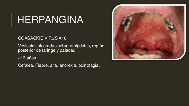 liver most cancers treatment alternatives