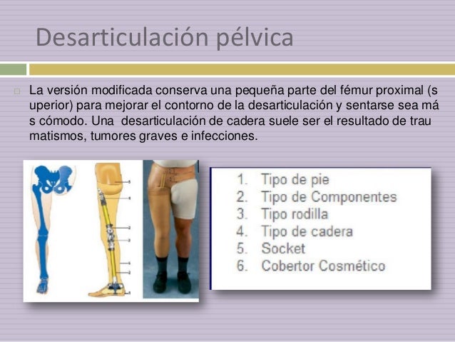 Amputación de miembros pélvicos, fisioterapia