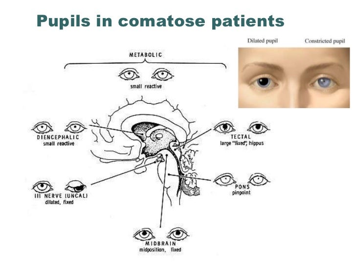 Altered Mental Status and Coma