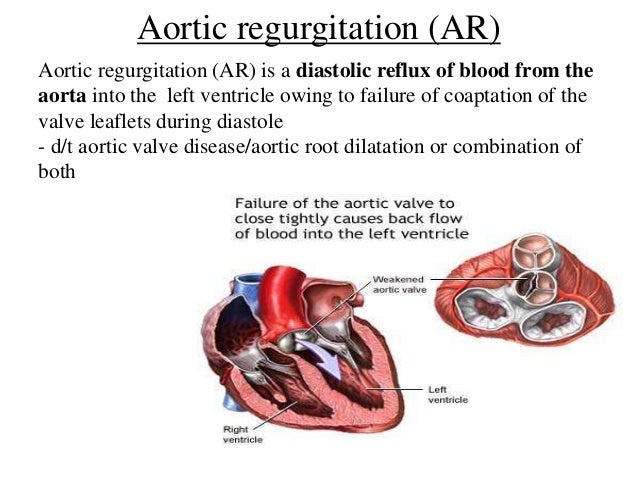 stroke recuperation trial fund
