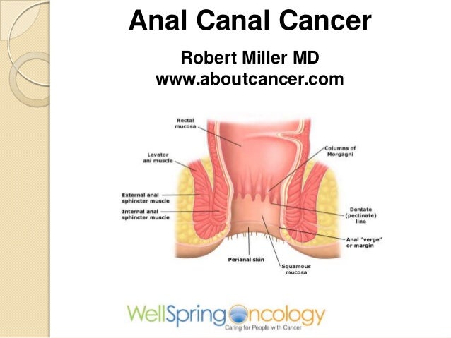 Anal cancer symptoms pictures