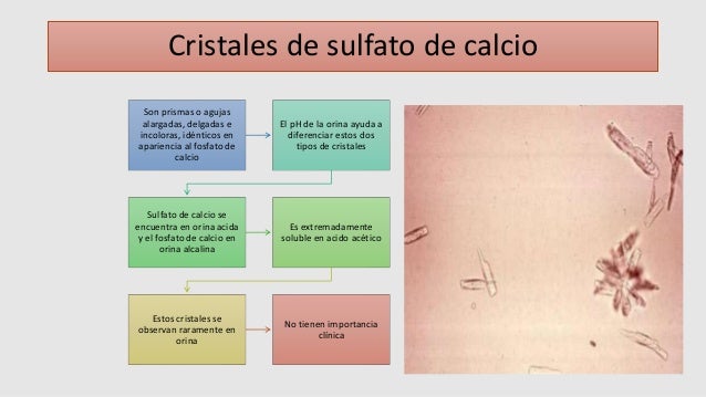 Analisis microscopico del sedimento urinario