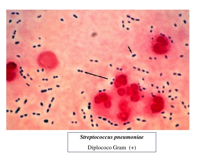 listeria monocytogenes haemophilus influenzae and mycobacterium Bacterial meningitis causes jump to: escherichia coli, listeria monocytogenes, and haemophilus influenzae type b. listeria monocytogenes haemophilus influenzae and mycobacterium Bacterial meningitis causes jump to: escherichia coli, listeria monocytogenes, and haemophilus influenzae type b.
