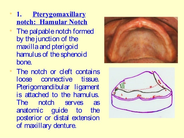 hamular notch car interior design hamular notch