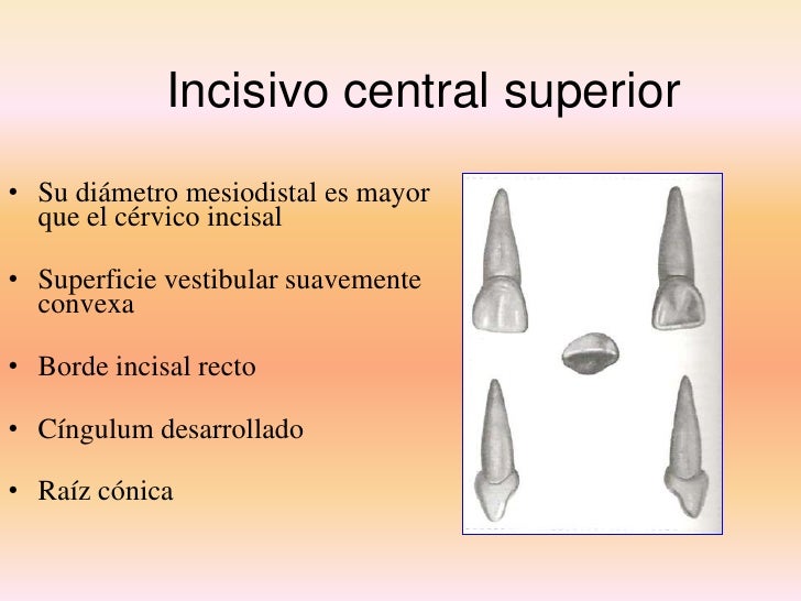Anatomía dientes temporales Anatomía dientes temporales
