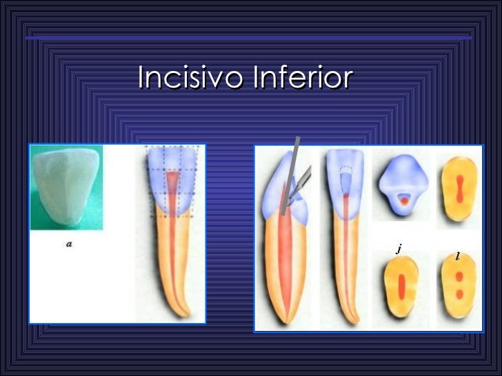 Anatomia De Los Conducto Radiculares F
