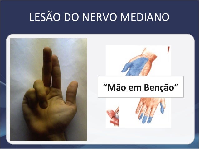 Em um pênis encabeçam pequenos lugares do calor brancos que ele