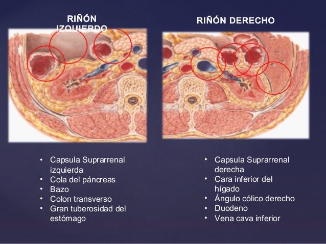 Medio De Fijacion De Los Riñones es.slideshare.net