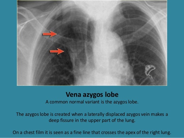 Anatomy of chest