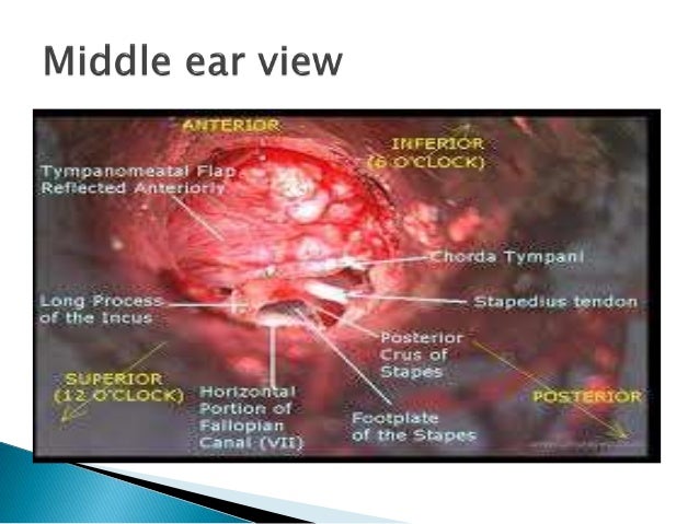 Anatomy of middle ear