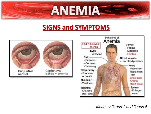 What are the causes of being anemic?