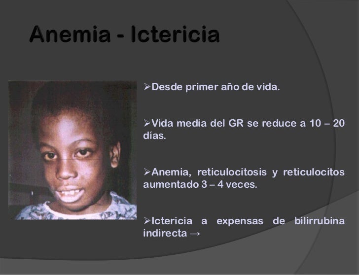 Los ejercicios. A la osteocondrosis del departamento de pecho de la columna vertebral