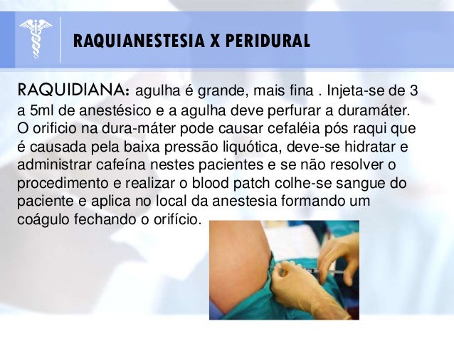 Anestesias
