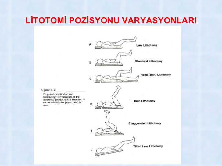 Anestezide Hasta Pozisyonlari