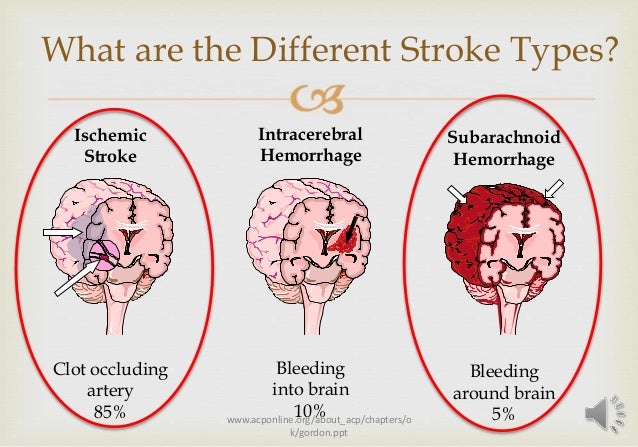stroke prevention vitamins