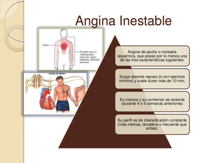 Angina de pecho estable e inestable