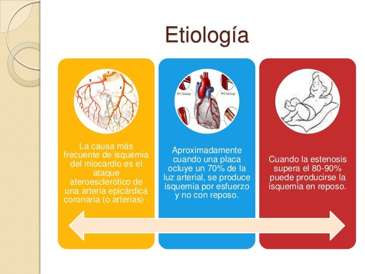 De pecho implanty del motivo la ergonomía