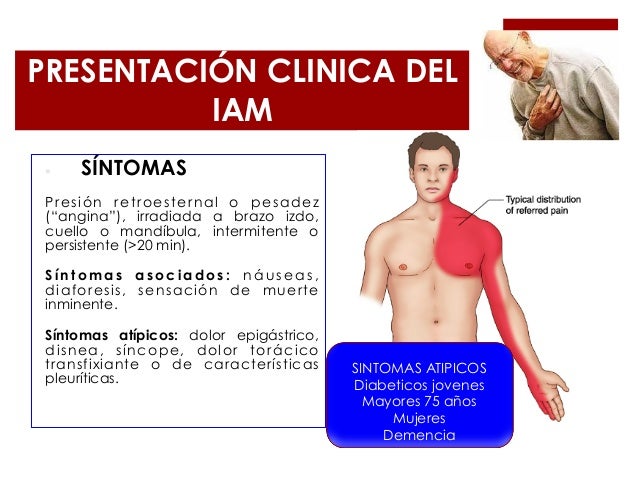 La trombosis después de la operación al pecho