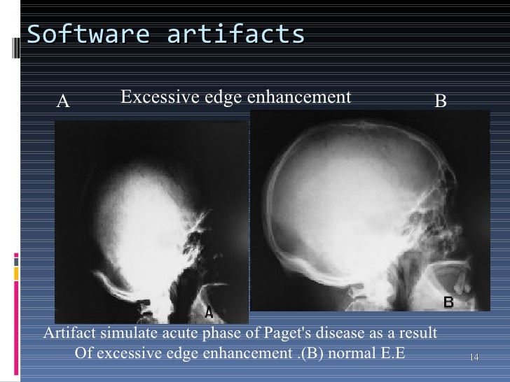 Anjali (qa qc on cr dr)