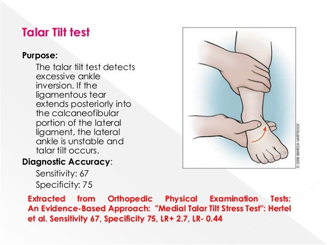 Exame tilt test