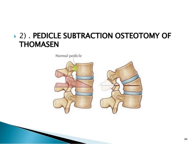 cervical most cancers holistic treatment