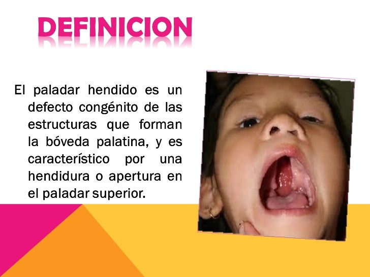La operación láser de los ojo minsk
