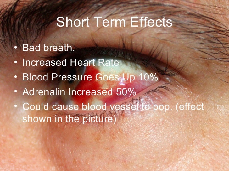 Anti chewing tobacco