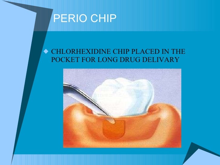 Antibiotic Adjuncts To Perio treatment