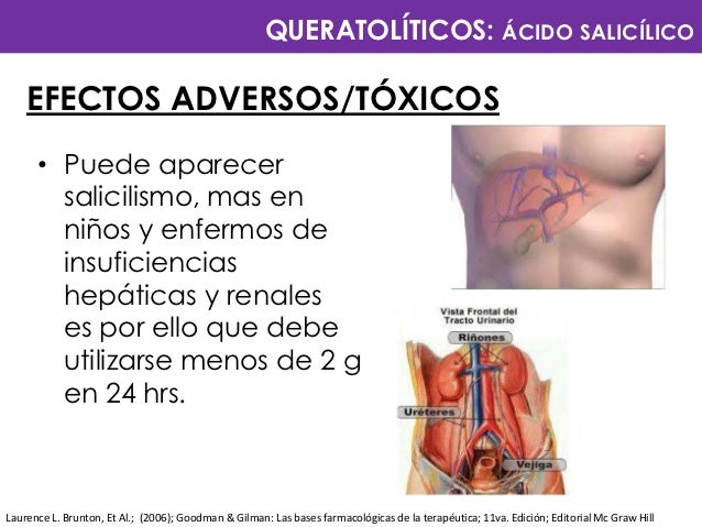 La psoriasis sobre los dedos por qué