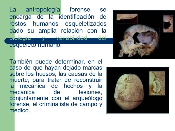 Antropología Forense