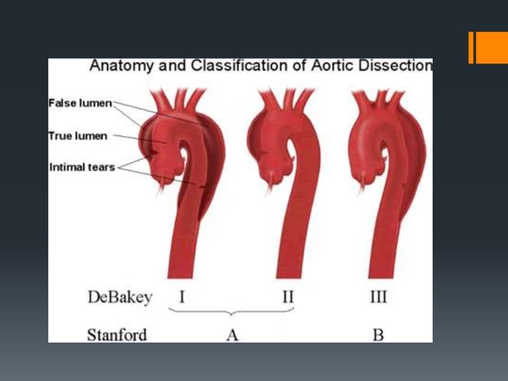 how to treat ascending aortic aneurysm