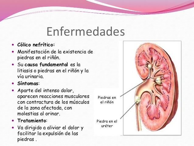 El vídeo la gimnasia bubnovskogo para la osteocondrosis sheynogo del departamento