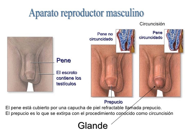 El modo de aumentar el miembro por medio de la cirugía