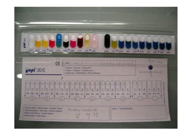 Api 20e Color Chart