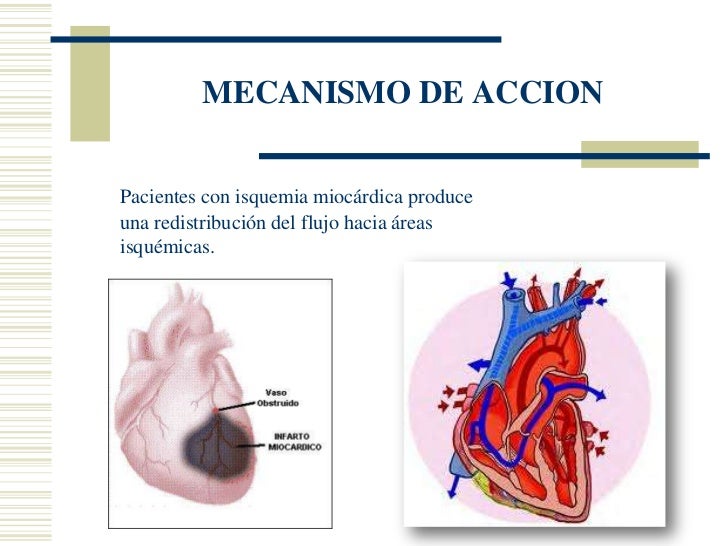 Aplicacion nitroglicerina en enfermeria